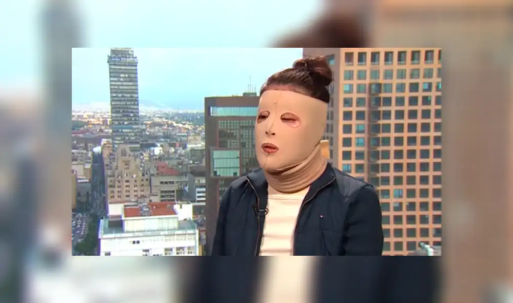 María Elena Ríos fue rociada con ácido por dos hombres el 9 de septiembre de 2019. (Foto: Captura)