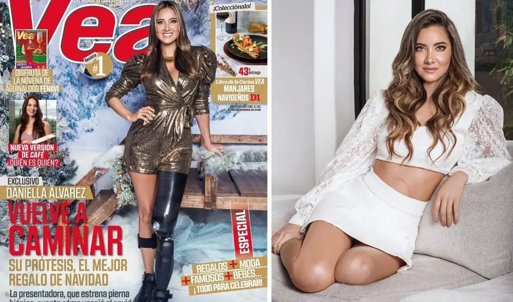 “Por fin tengo mi prótesis. Qué momento más bonito poder compartirla con ustedes", escribió la modelo en redes sociales. Foto: composición Instagram