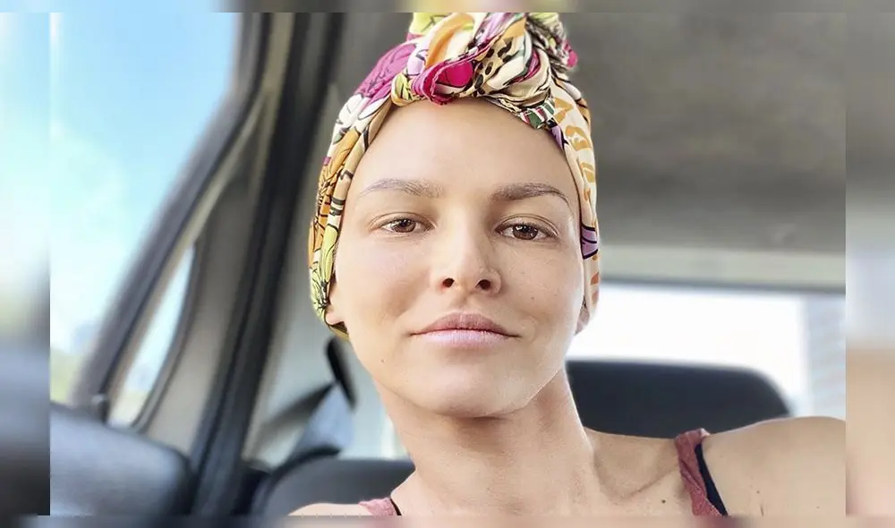 Anahí de Cárdenas confiesa la mejoría que presenta en su salud. Foto: Instagram