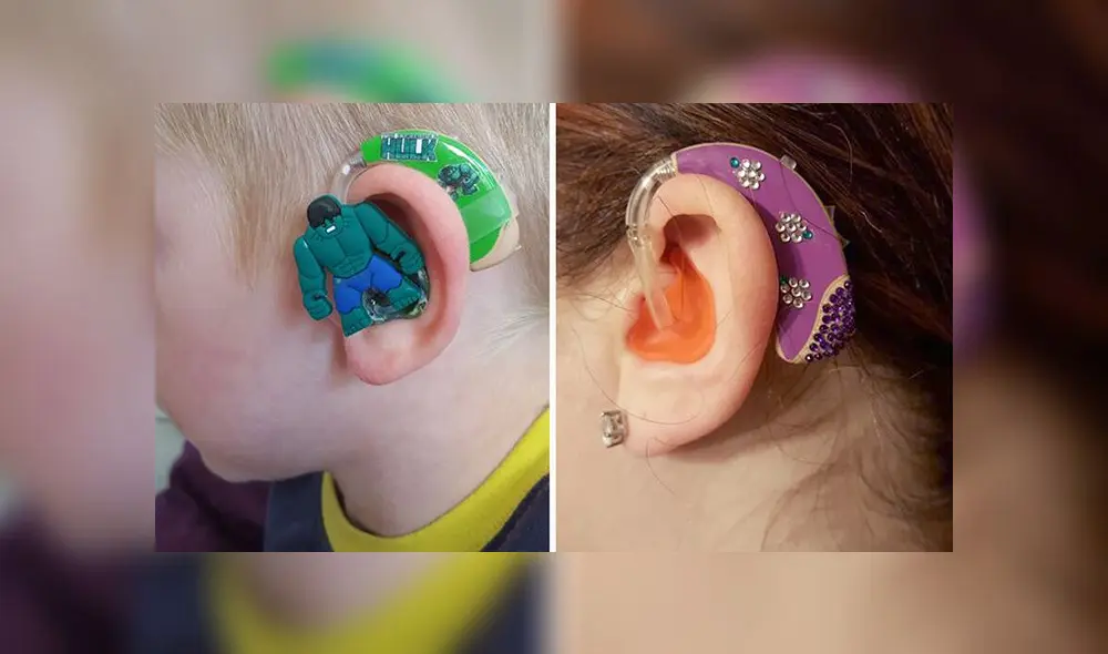 Mother to a partially deaf boy, Sarah Ivermee started selling hearing-aid decals for kids who might not otherwise be excited about wearing an earpiece.