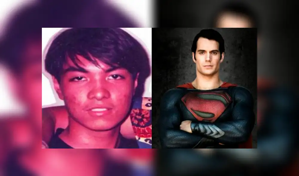 En Facebook, es fan de Superman, se operó para parecerse a él y su cambio es increíble [FOTOS] 