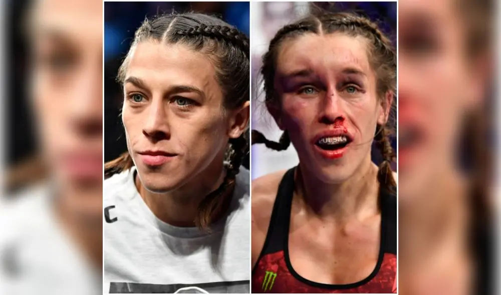 Joanna Jedrzejczyk, antes y después de la pelea. Joanna Jedrzejczyk, antes y después de la pelea.