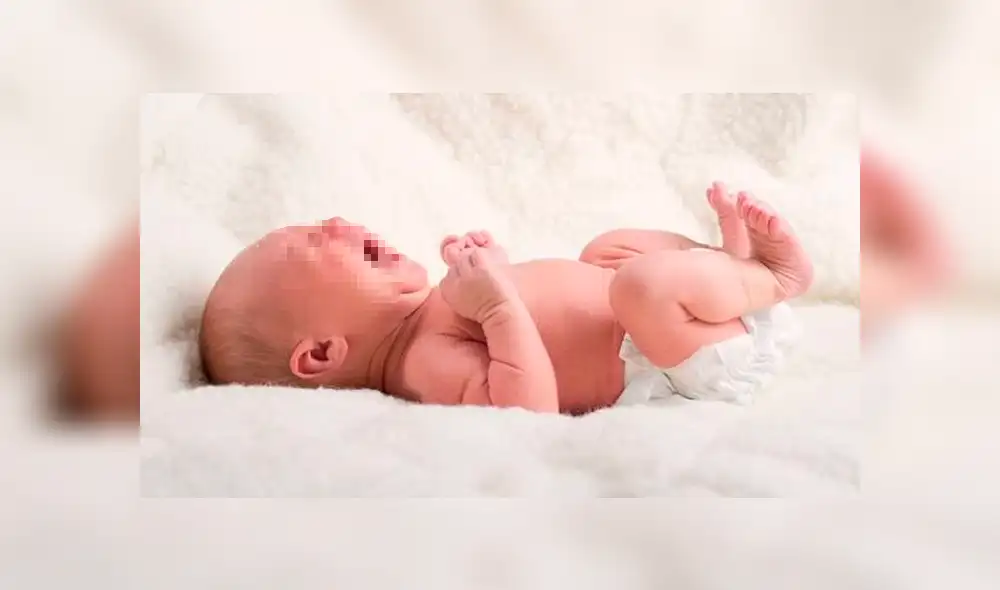 Bebé queda desfigurado tras ser cortado por los médicos durante cesárea [FOTOS] 