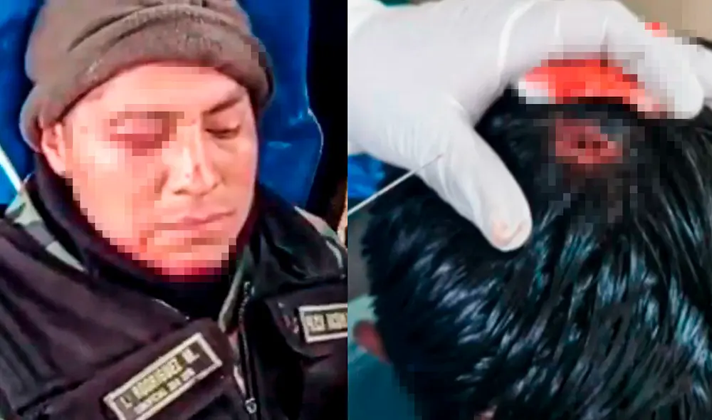 Heridos en protestas en Andahuaylas. Foto: captura de Contacto Directo