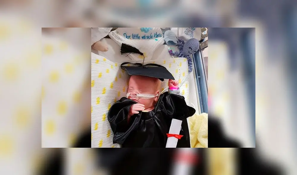 Nació con 500 gr de peso y llega a su primer año de vida contra todo pronóstico [FOTOS]