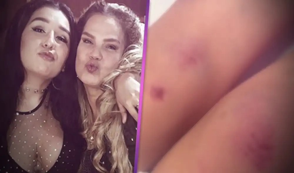 Hija de Niurka Marcos viene recuperándose tras sufrir accidente. Foto: Composición Hija de Niurka Marcos viene recuperándose tras sufrir accidente. Foto: Composición