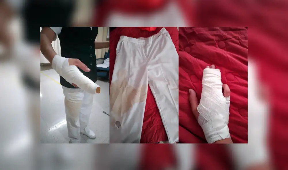 “Yo te cuido, pero tú a mí no”: enfermera mexicana denuncia agresión de una familia ante temor al coronavirus “Yo te cuido, pero tú a mí no”: enfermera mexicana denuncia agresión de una familia ante temor al coronavirus