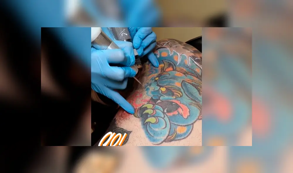 Facebook viral: joven intenta quitarse tatuaje del brazo, sin imaginar el terrible resultado que tendría