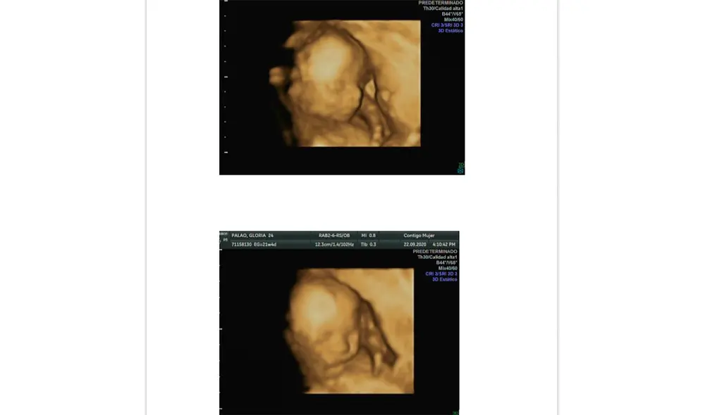 Gloria mostró la ecografía de su pequeña en sus redes sociales. Foto: Instagram
