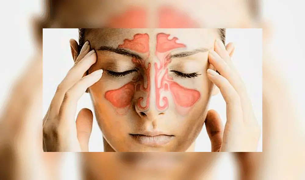 Alivia los síntomas de la sinusitis con estos remedios caseros 