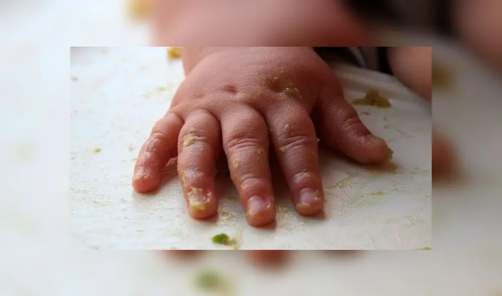 Australia: caso sobre nutrición vegana en bebes vuelve a sorprender Australia: caso sobre nutrición vegana en bebes vuelve a sorprender