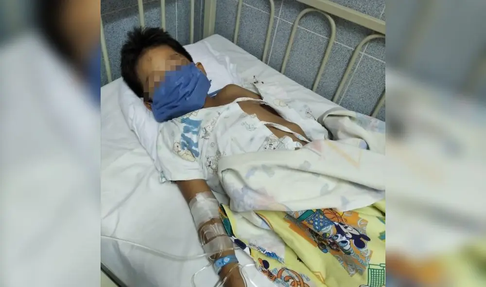 Menor tiene fractura hace 8 días. Menor tiene fractura hace 8 días.