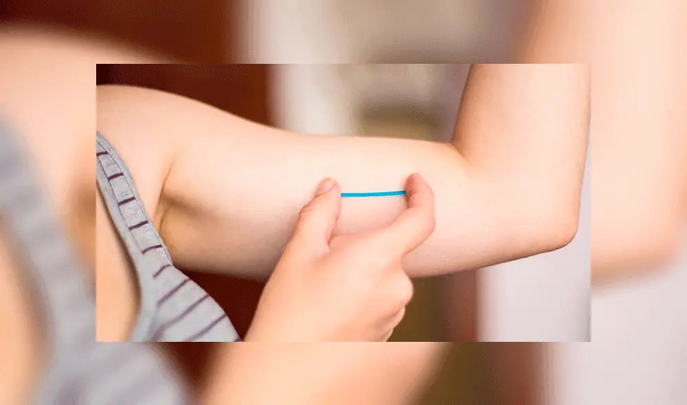 Implantes subdérmicos Implantes subdérmicos