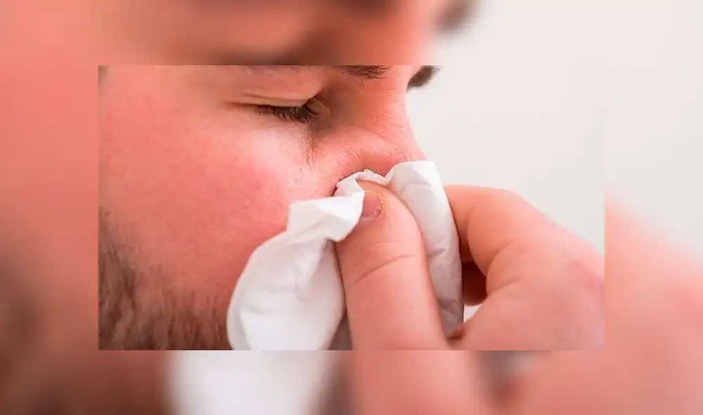 El esfuerzo al sonarse la nariz puede afectar a las venas del cerebro y provocar derrame. Foto: referencial