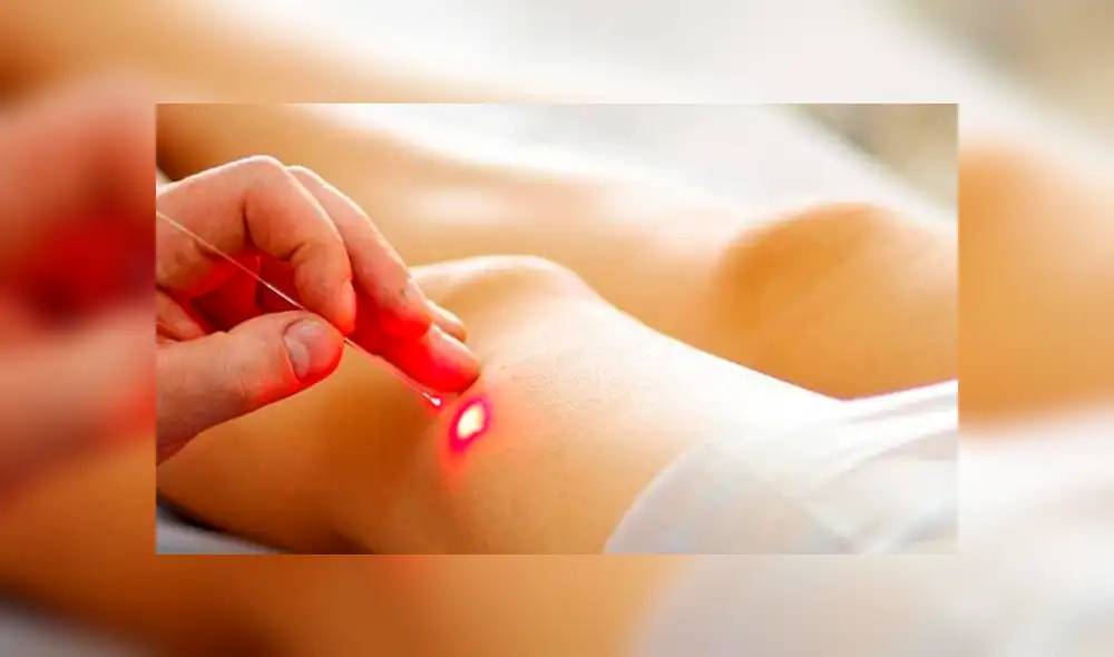 Nuevo láser podría frenar metástasis al atacar y matar a células cancerosas desde afuera 