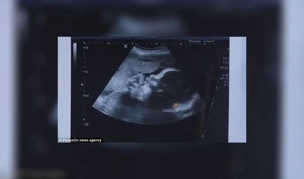 Brasil: Mujer embarazada recibió disparo y la bala impactó al bebé