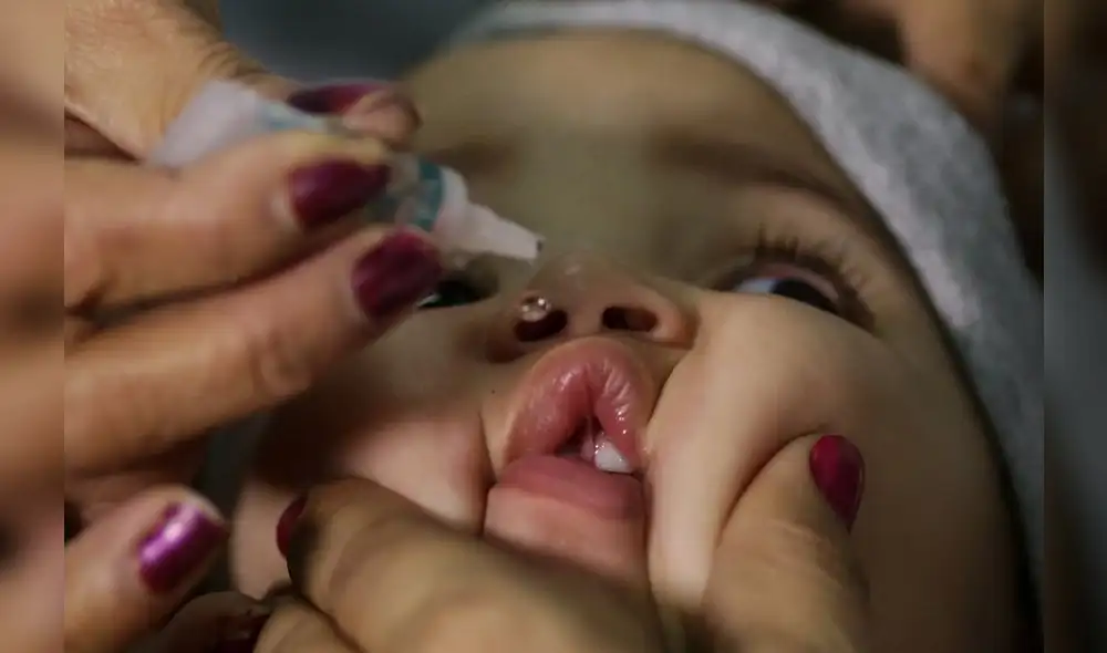 Callao: reportan 6 nuevos casos de sarampión en niños menores de 6 años