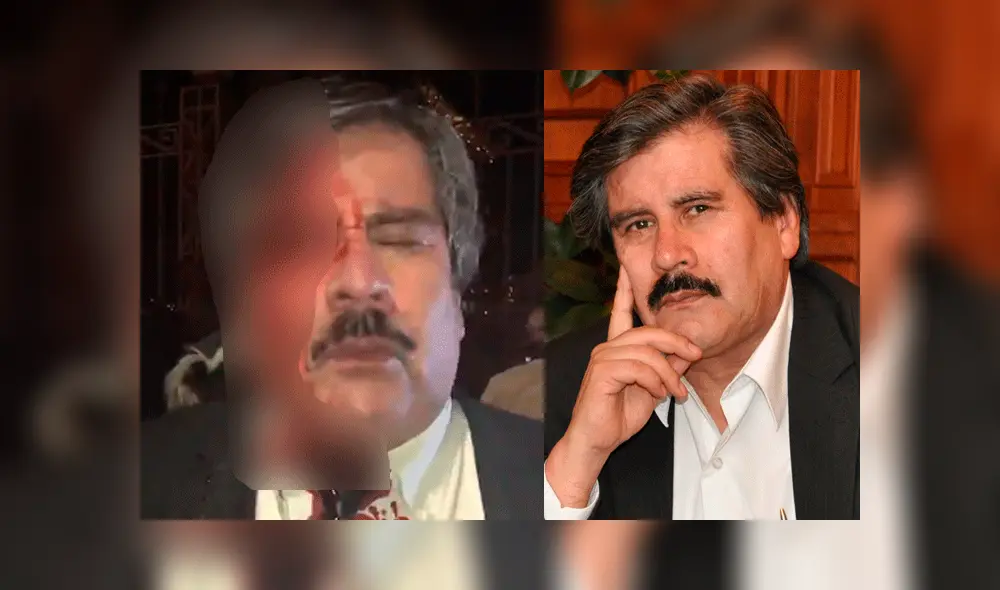 Walter Albarracín se encuentra recuperando luego de la agresión de los simpatizantes de Evo Morales.