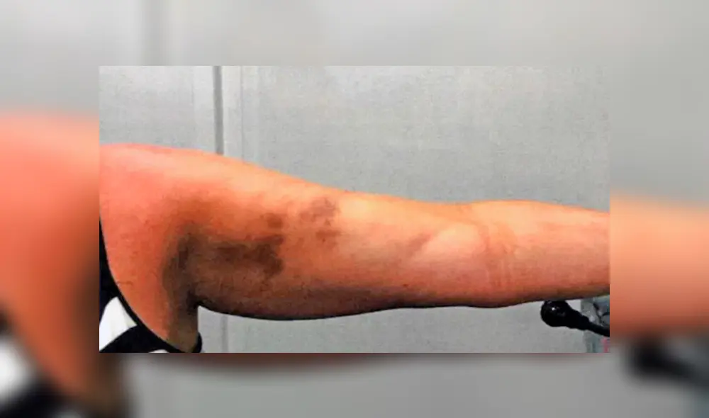 Finge estar muerta para evitar que exnovio que conoció en Tinder la siga golpeando [FOTOS] 