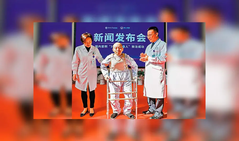 Tuvo el cuerpo doblado por casi tres décadas y volvió a la normalidad gracias a operación [FOTOS]