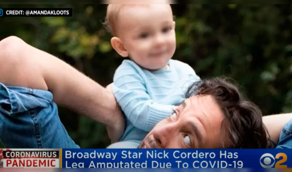 Nick Cordero, actor de Brodway, sufre la amputación de una pierna por el coronavirus Nick Cordero, actor de Brodway, sufre la amputación de una pierna por el coronavirus