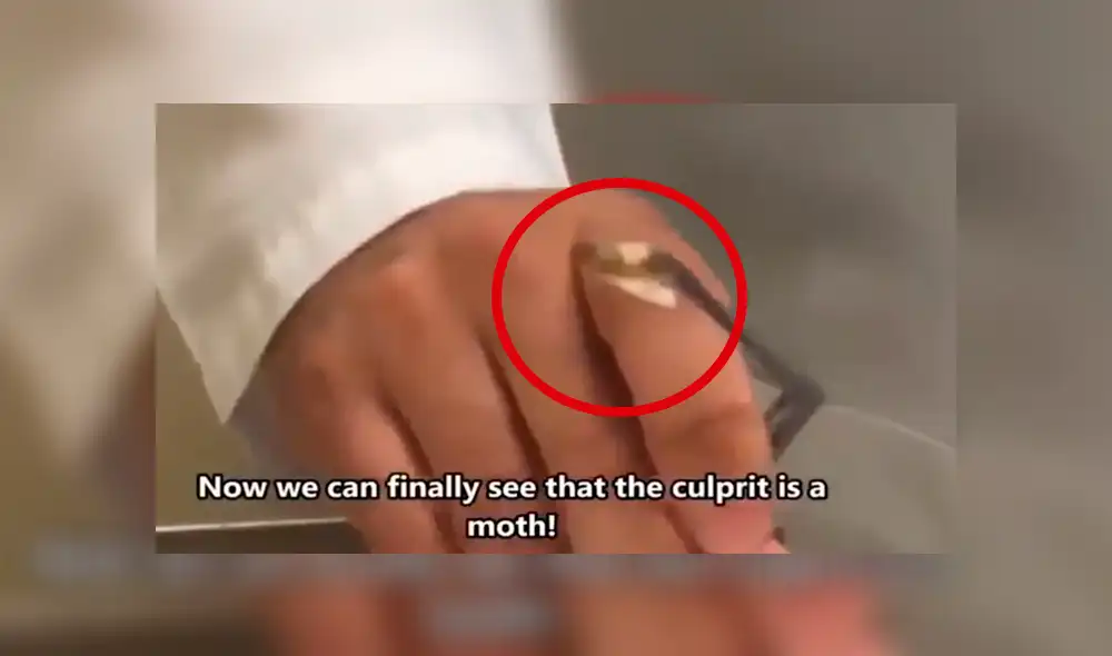 Facebook viral: nunca imaginarás la aterradora criatura que encontró este joven dentro de su oído [VIDEO] 