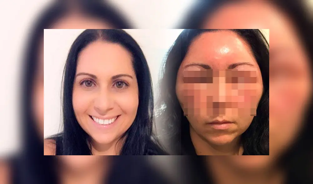 Julie Yacoub quedó internada en un hospital tras desatar complicaciones en su piel al pintarse el cabello. Foto: Difusión