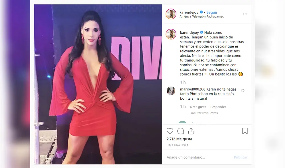 Karen Dejo deforma su rostro y usuarios hacen cruel comparación Karen Dejo deforma su rostro y usuarios hacen cruel comparación