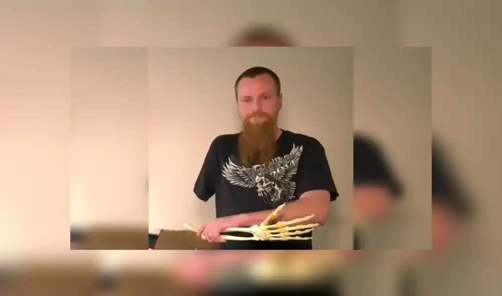 Hombre conserva los huesos disecados del brazo que le amputaron