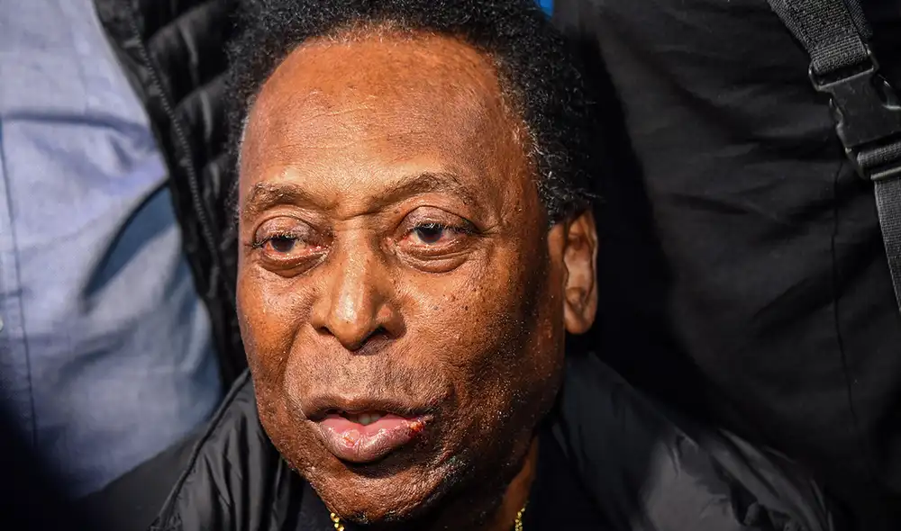 Pelé lucha contra el cáncer de colon desde hace más de un año. Foto: AFP Pelé lucha contra el cáncer de colon desde hace más de un año. Foto: AFP