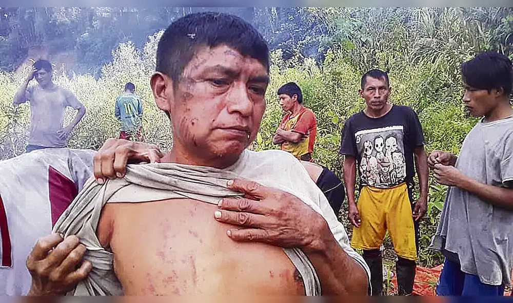 Ocho indígenas heridos en enfrentamiento con mineros informales de Ecuador Ocho indígenas heridos en enfrentamiento con mineros informales de Ecuador