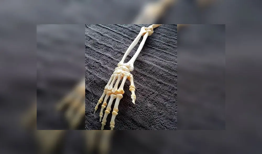 Hombre conserva los huesos disecados del brazo que le amputaron [FOTOS]