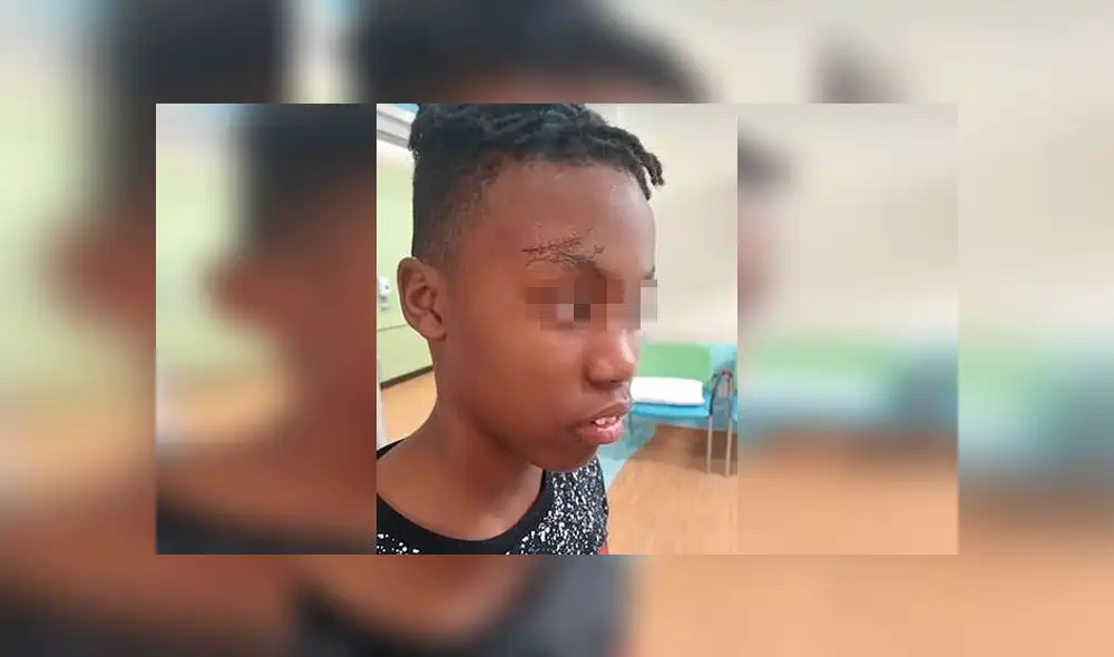 Niño fue llevado al hospital en helicóptero tras presunta agresión de su profesor [VIDEO]