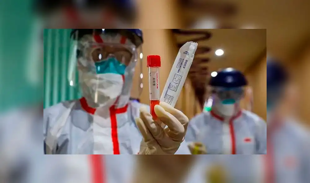 Área de Epidemiología de Arequipa da recomendaciones acerca del tratamiento del coronavirus. Área de Epidemiología de Arequipa da recomendaciones acerca del tratamiento del coronavirus.