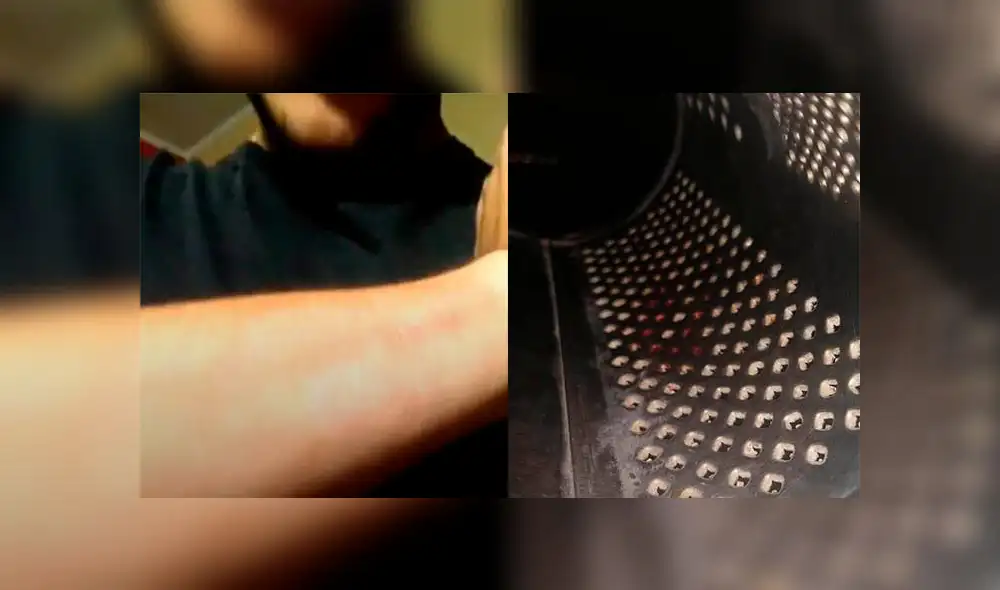 Chico que usó rallador de queso para borrar su tatuaje: “Me dolió y sangró muchísimo” [VIDEO]