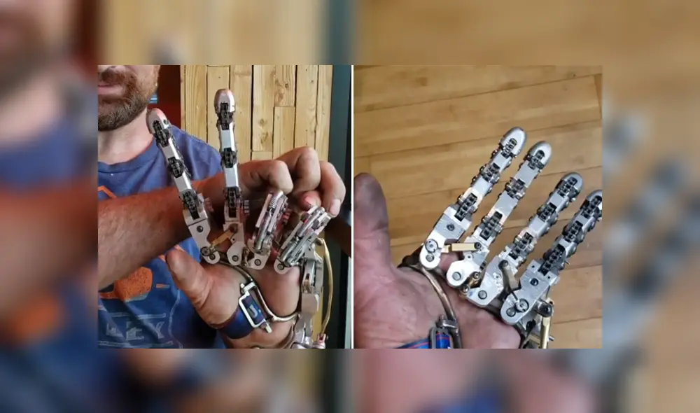 El hombre decidió hacerse una prótesis para la mano luego de que le amputaran cuatro dedos. Foto: Instagram El hombre decidió hacerse una prótesis para la mano luego de que le amputaran cuatro dedos. Foto: Instagram