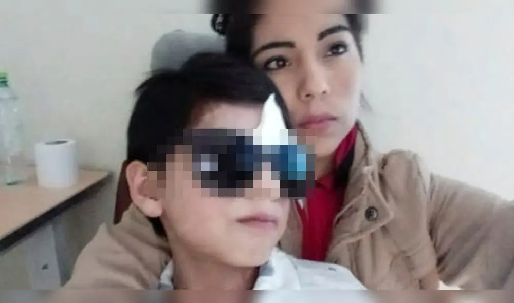 Arequipa: Piden ayuda para niño que perdió visión de un ojo por enfermedad