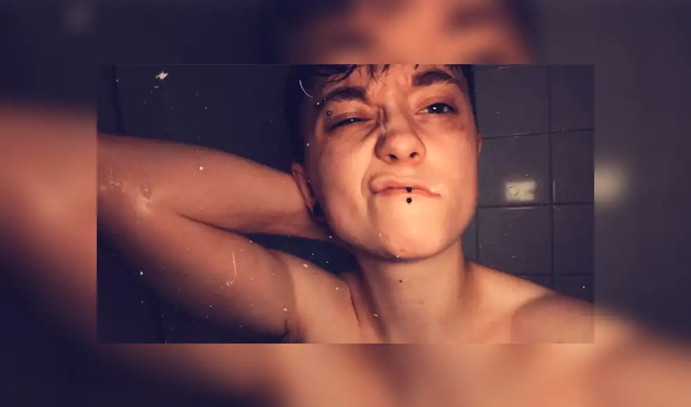 Una mujer lesbiana que fue brutalmente atacada en las calles de Inglaterra compartió fotos de sus heridas para crear conciencia sobre la realidad de la homofobia en la actualidad.