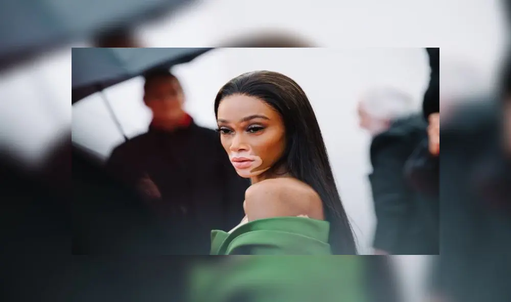 Maluma y Winnie Harlow: modelo publicó una foto junto al cantante colombiano donde se les ve cariñosos Maluma y Winnie Harlow: modelo publicó una foto junto al cantante colombiano donde se les ve cariñosos