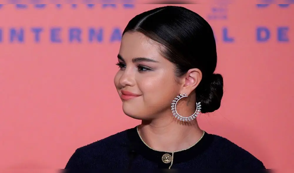 Selena Gomez ha tenido drástico cambios en su físico tras ser diagnosticada con lupus.