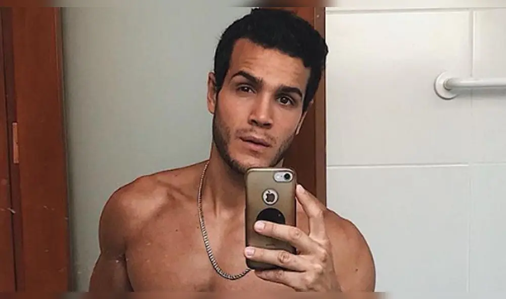 Mario Irivarren confiesa a cuántas cirugías se sometió para mejorar su imagen