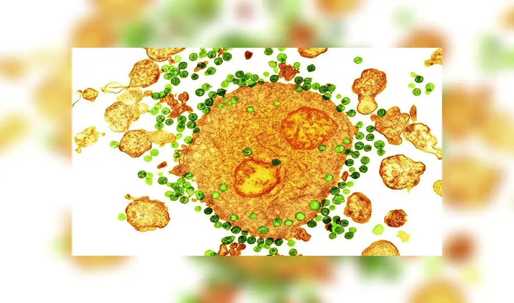 ¡Paciente con VIH se libra de virus del sida por segunda vez en la historia!