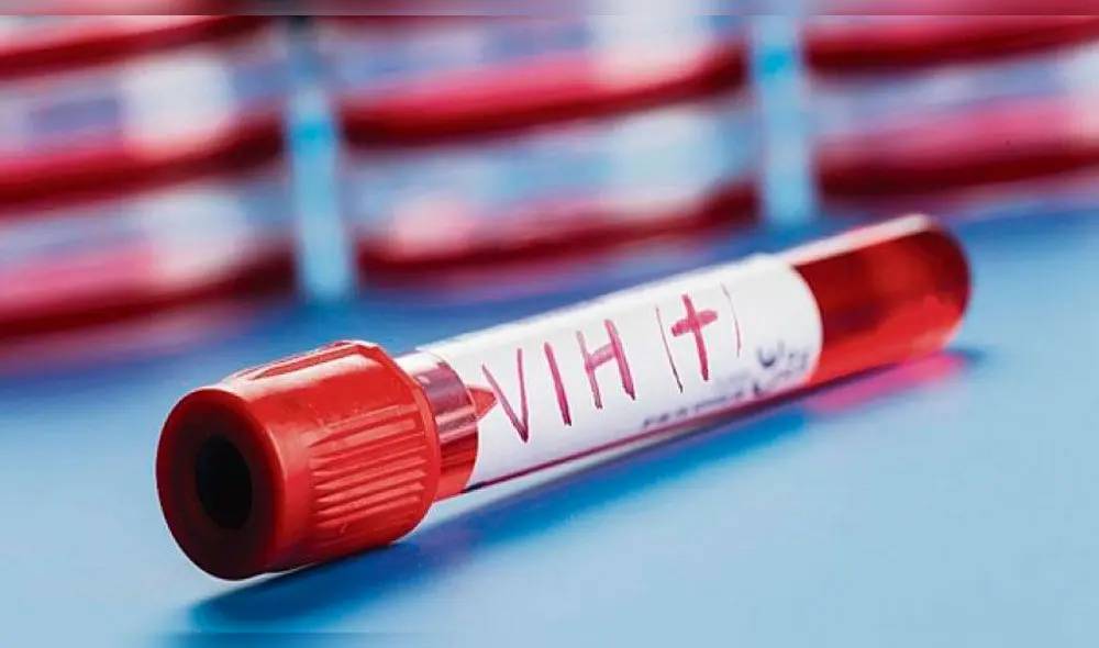 Se estima que de cinco personas contagiadas, una desconoce estar viviendo con el virus. Foto: Difusión