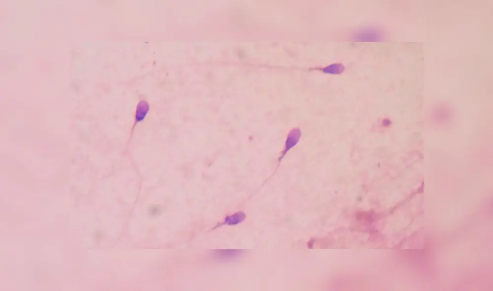 La nanocontracepción surge como una alternativa a los métodos anticonceptivos clásicos en el público masculino. Foto: Wikipedia.