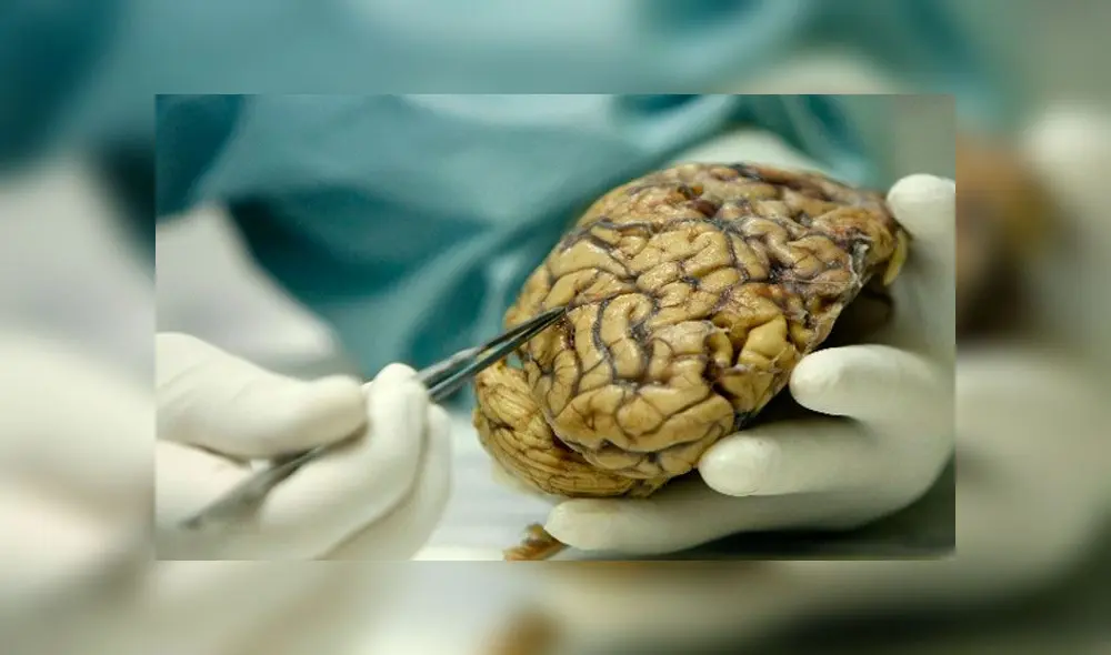 La materia gris del cerebro es vital para procesar información en el cerebro. Foto: EFE. La materia gris del cerebro es vital para procesar información en el cerebro. Foto: EFE.