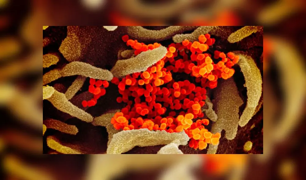 Imagen de microscopio electrónico que muestra al SARS-CoV-2 aislado de un paciente en EE. UU. Crédito: NIAID. Imagen de microscopio electrónico que muestra al SARS-CoV-2 aislado de un paciente en EE. UU. Crédito: NIAID.