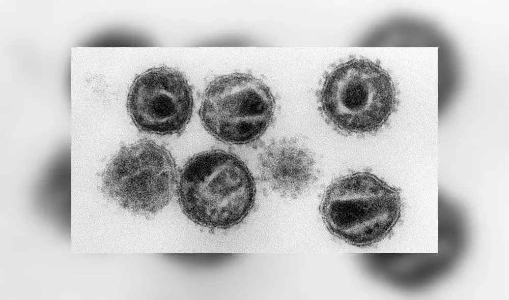 Imagen del virus VIH, que causa el sida. Foto: Instituto Robert Koch.