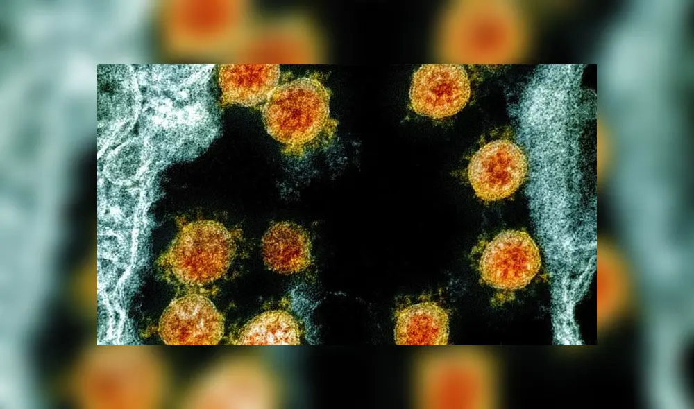 Partículas del nuevo coronavirus en un paciente. Foto: NIAID.