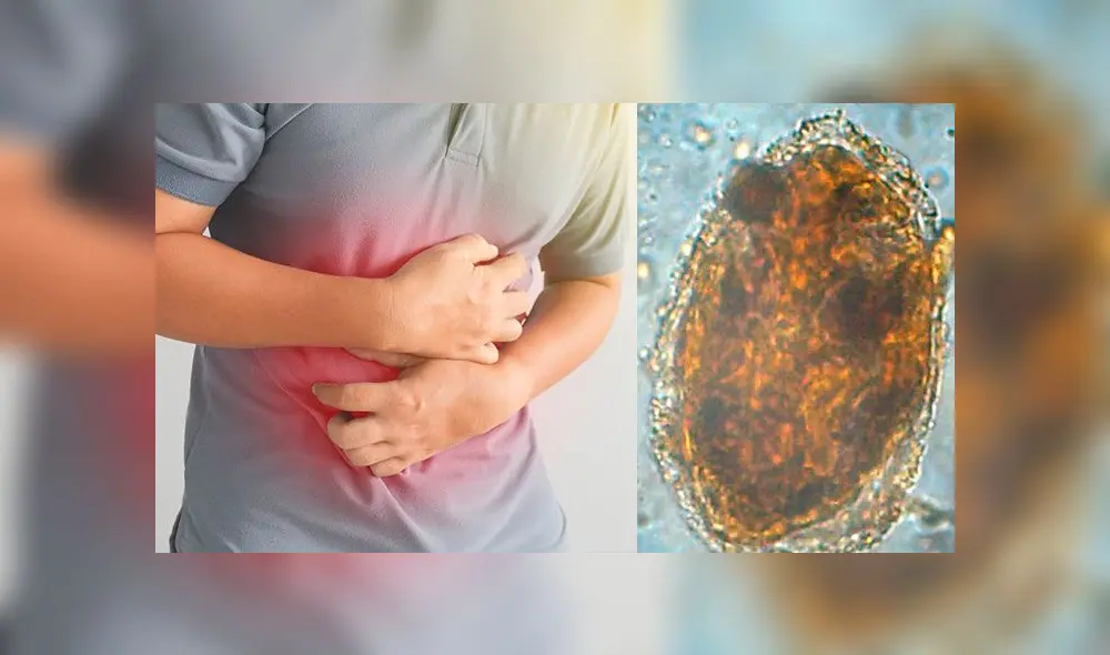 Advierten riesgo de contraer enfermedad, especialmente en verano. Foto: composición/La República