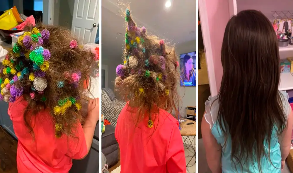 El hermano de la menor le lanzó un contenedor completo de juguetes con velcro que terminaron en el cabello de la niña. Foto: captura de Facebook de Lisa Hoelzle